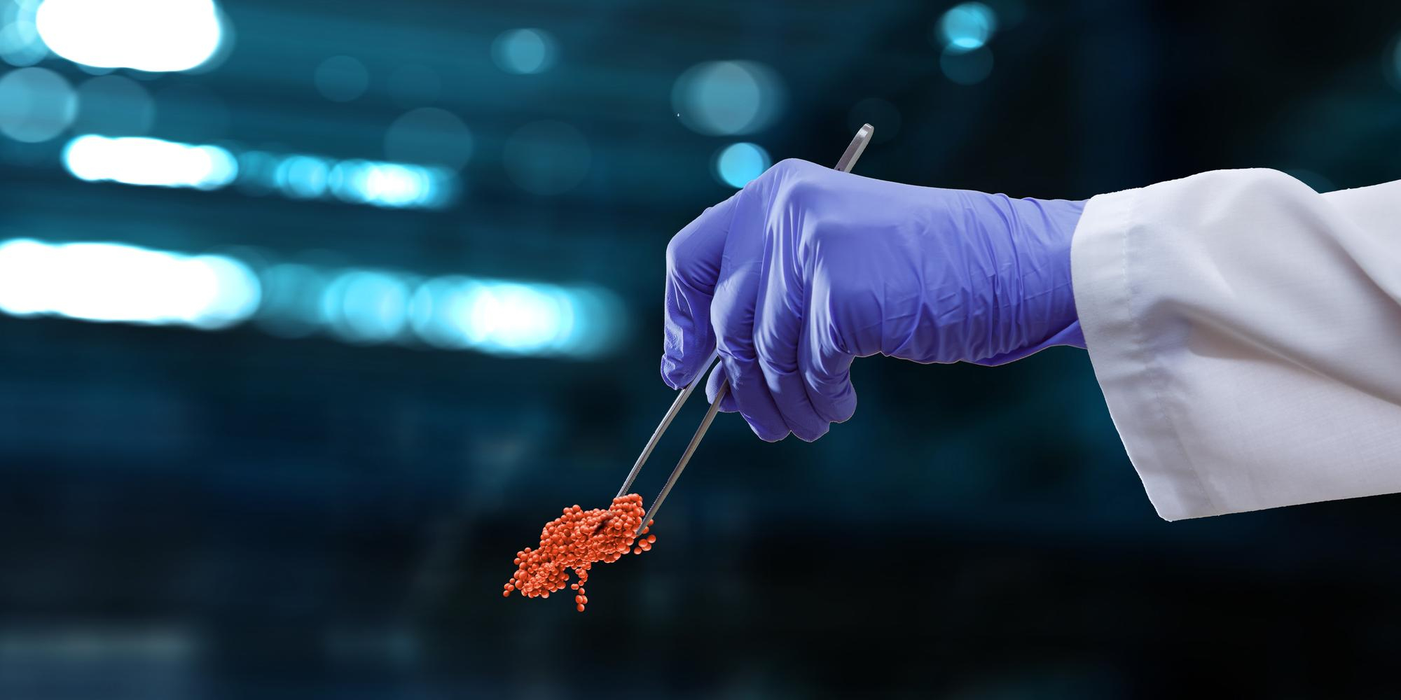 Conheça os tipos de biópsias guiadas por imagem e suas indicações